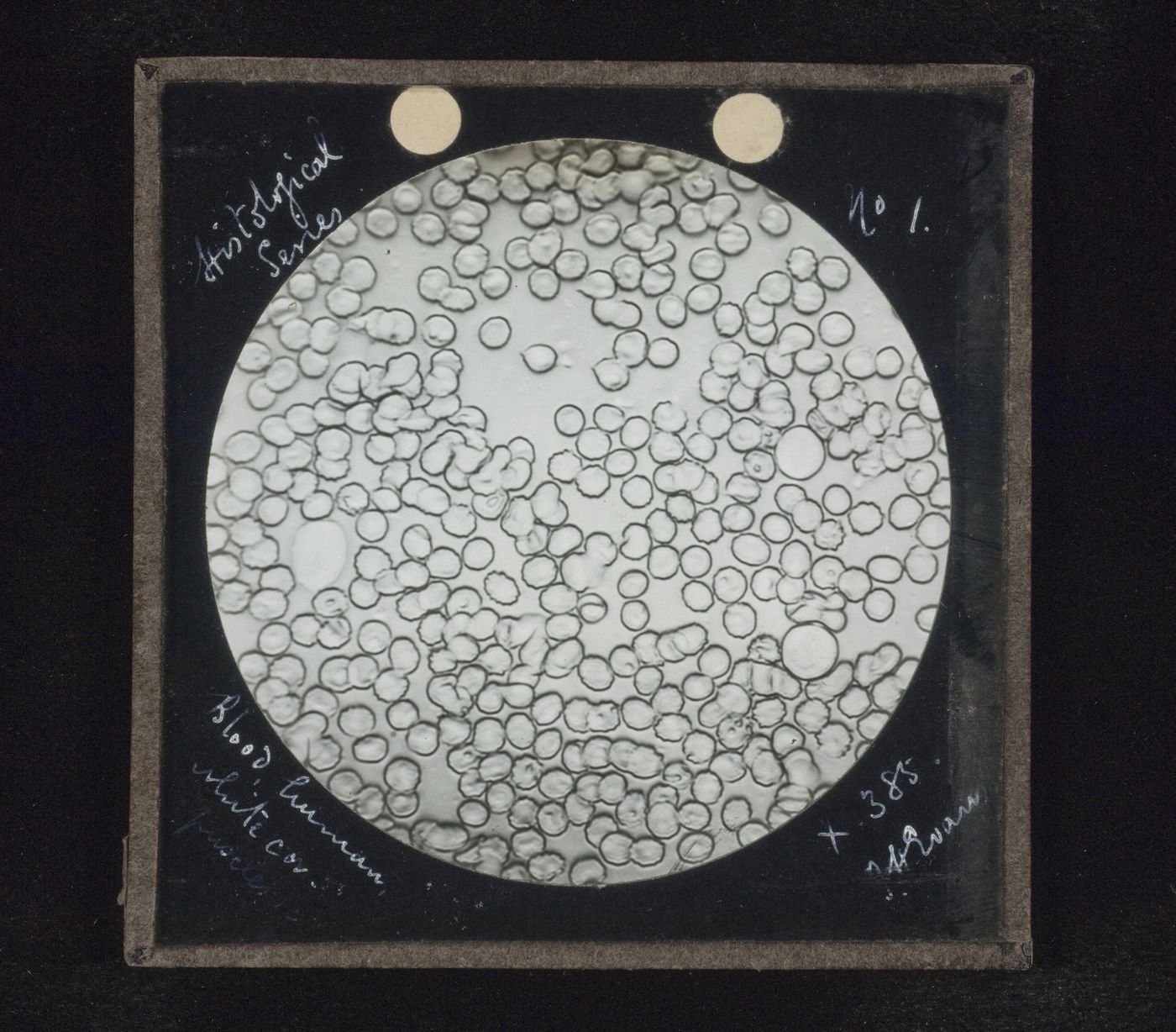 Photomicrograph of white corpuscles of human blood