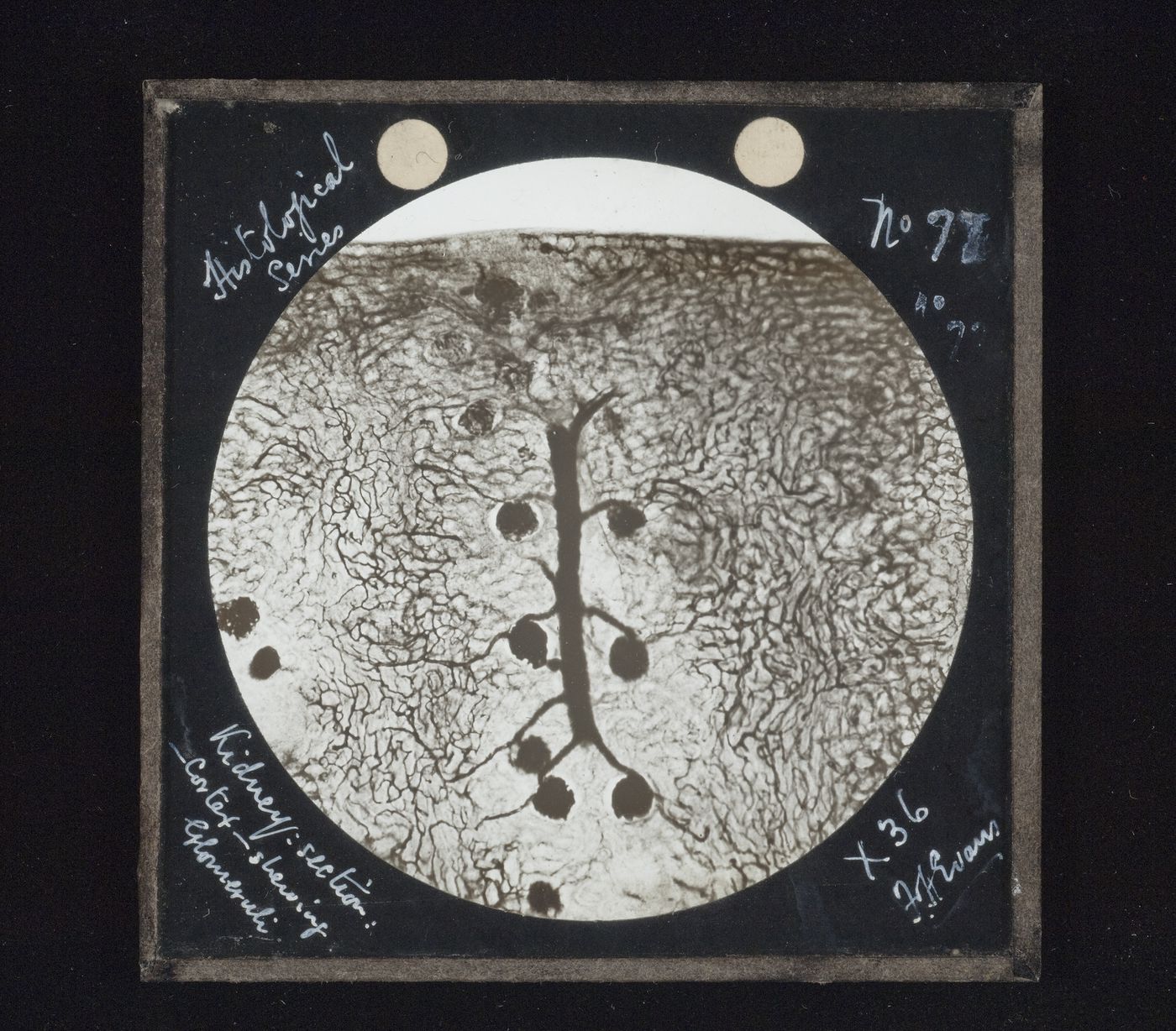Photomicrograph of section of kidney with glomeruli
