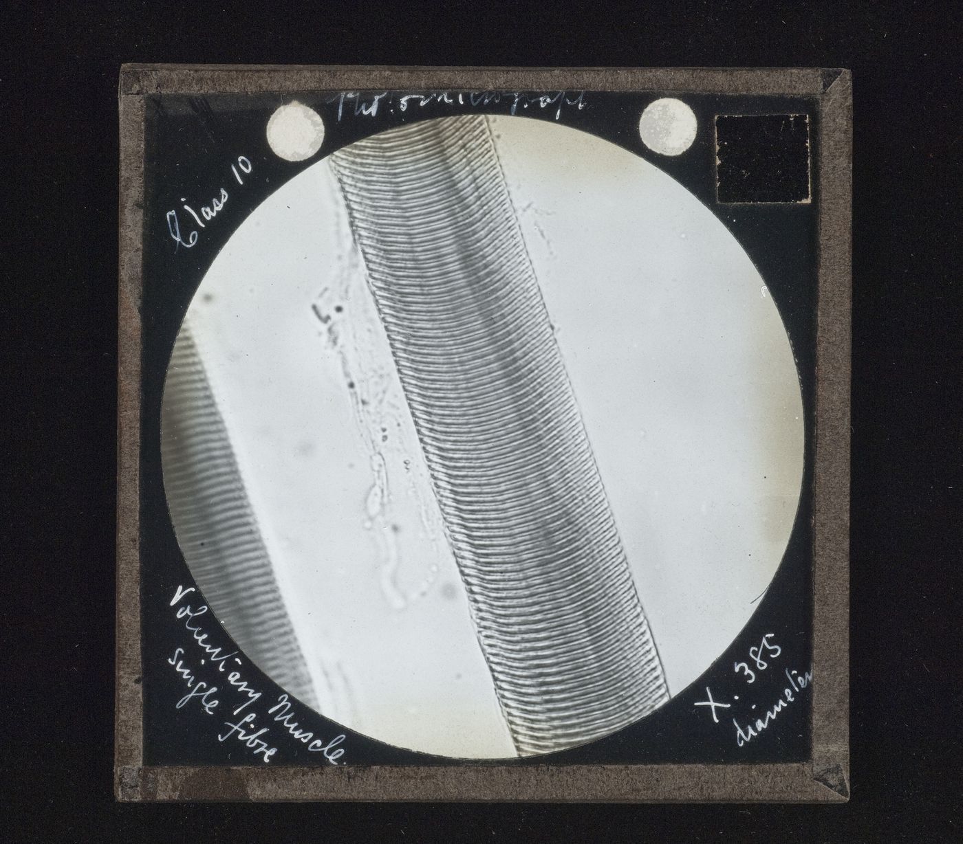 Photomicrograph of single fibre of voluntary muscle