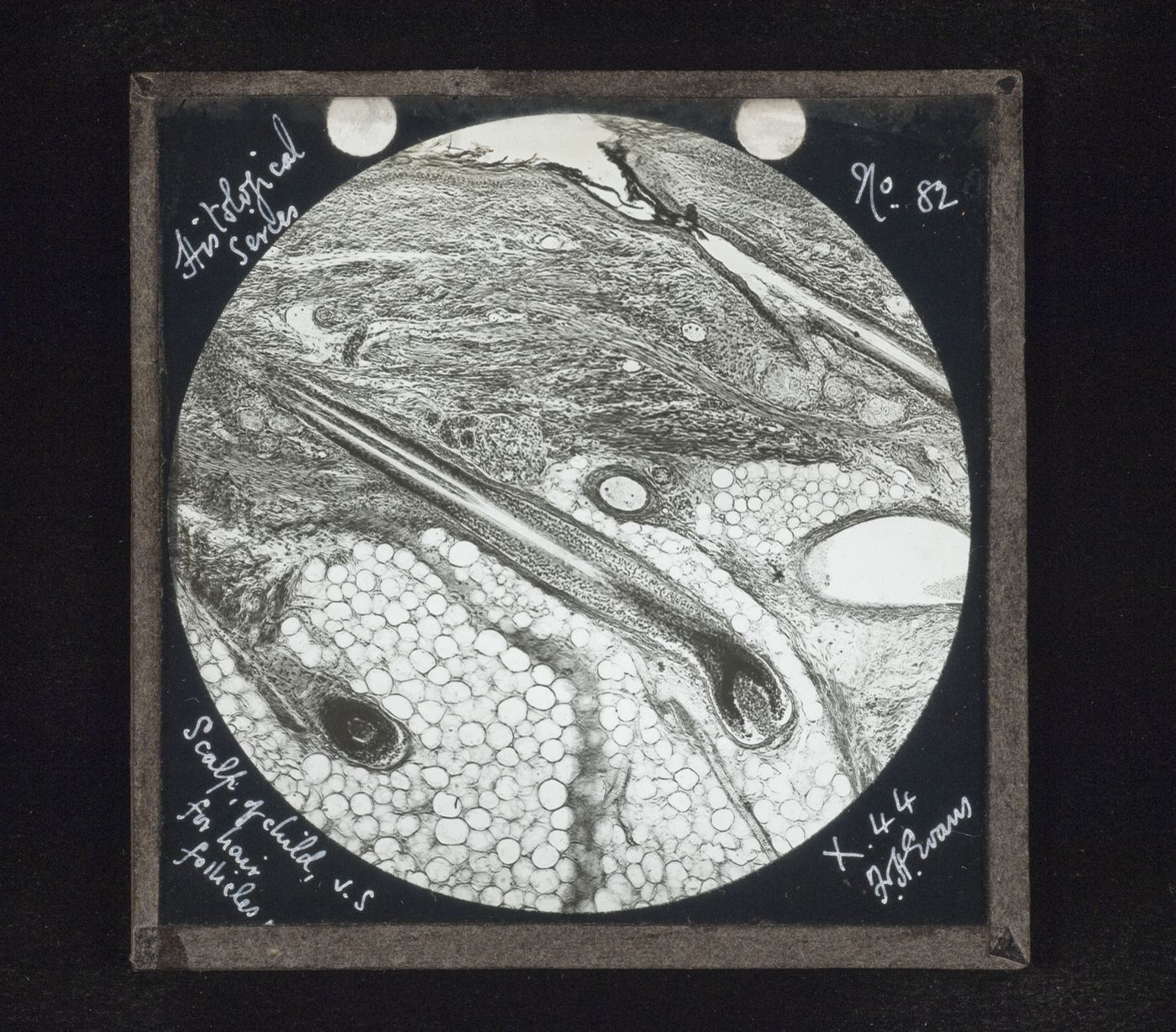 Photomicrograph of hair follicles of scalp of child