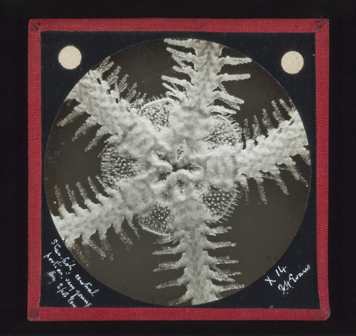 Photomicrograph of central portion of young starfish