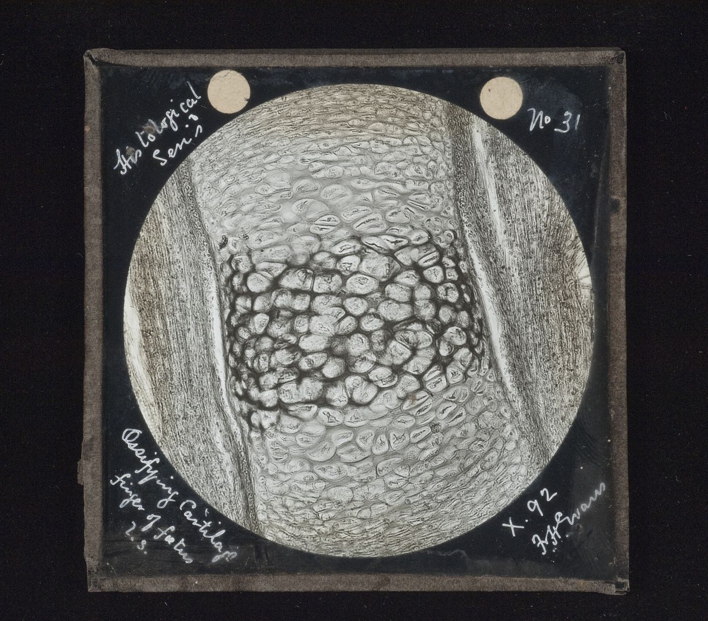 Photomicrograph of ossifying cartilage of finger of fetus