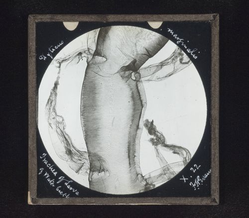 Photomicrograph of trachea of larva of water beetle (Dytiscus marginalis)