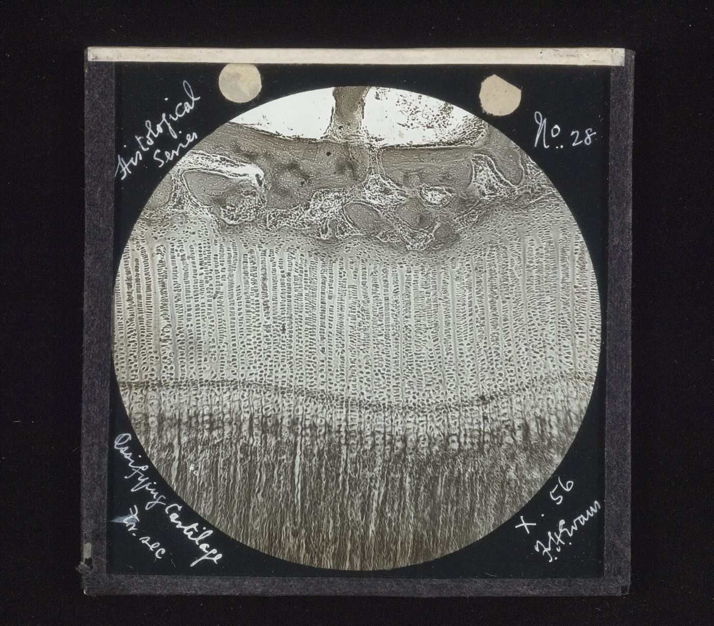 Photomicrograph of ossifying cartilage from historical series