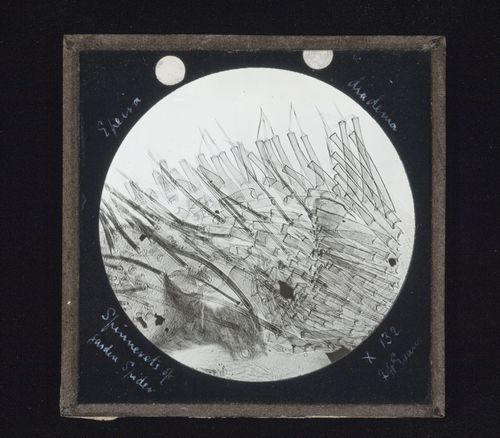 Photomicrograph of spinnerets of garden spider (Epeira diadema)