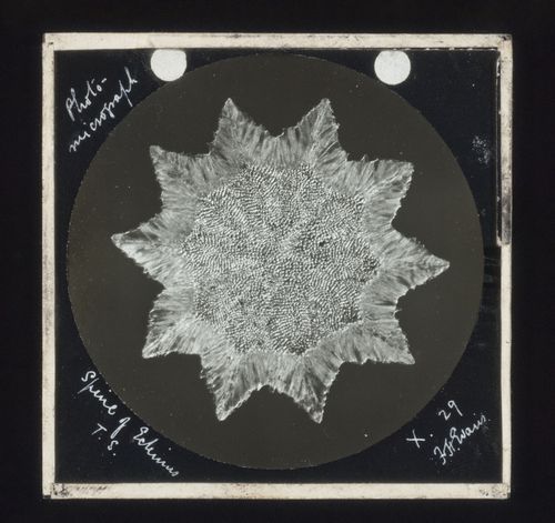 Photomicrograph of spine of echinus