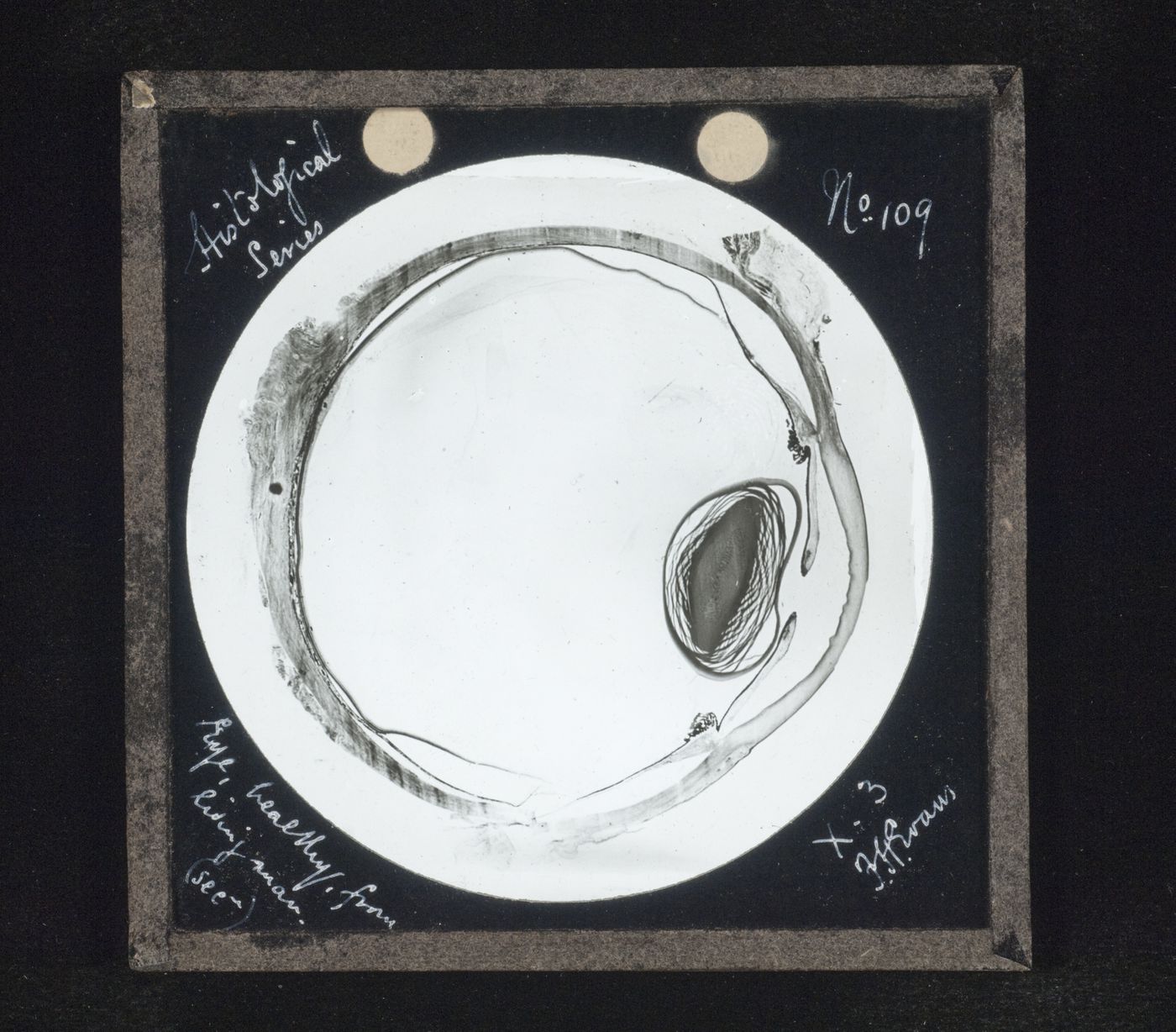 Photomicrograph of healthy eye of living man