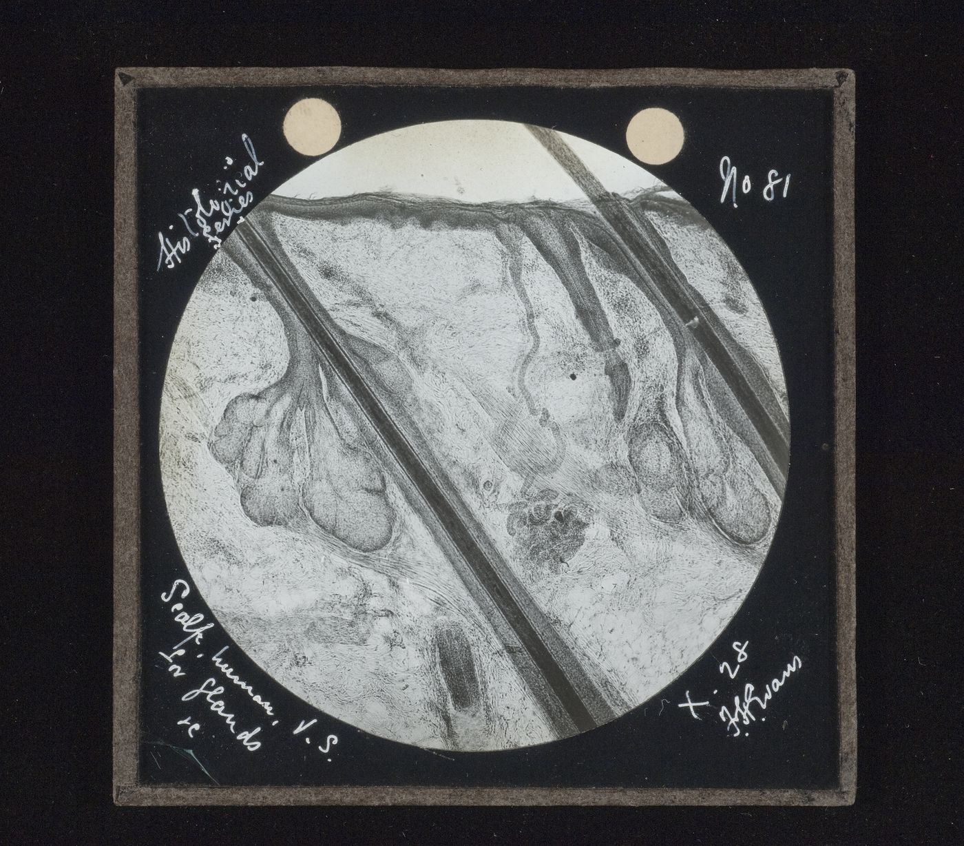 Photomicrograph of human scalp from historical series