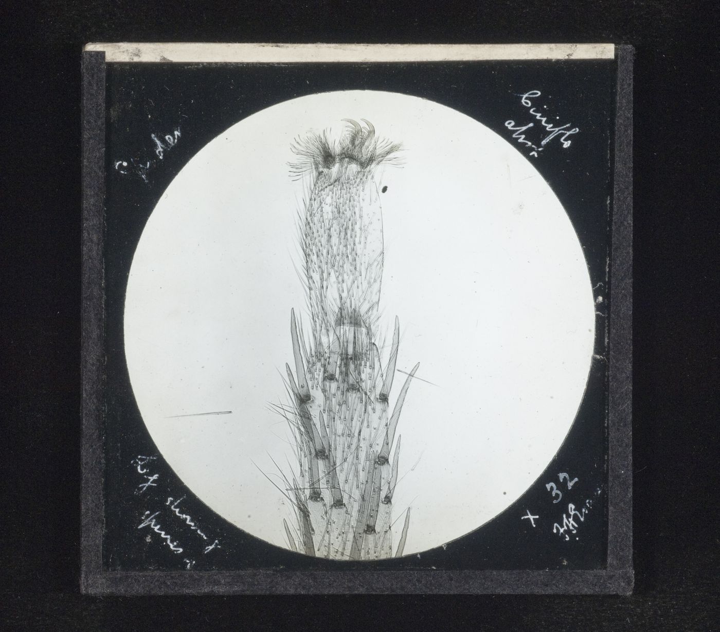 Photomicrograph of leg showing spines of spider